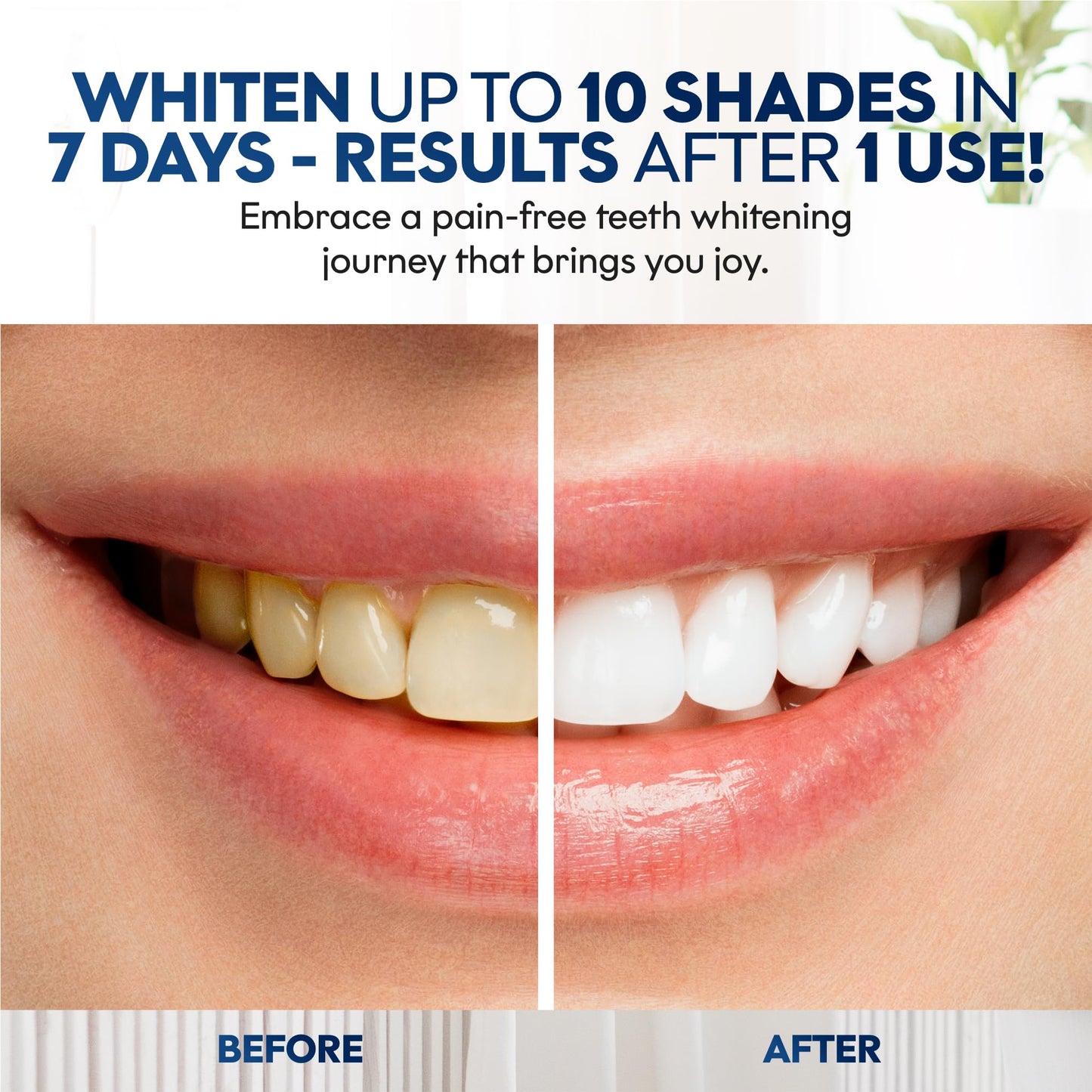 Teeth Whitening Strips | 14 Strips - 7-Day Mint-Flavored Treatments for Sensitive Teeth | Non-Toxic Whitening Strips | Enamel Safe & Peroxide-Free | Removes Stains in 7 Days | Teeth Whitening