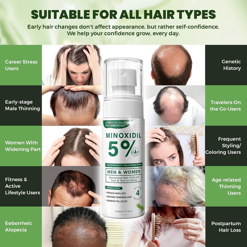 5% Minoxidil Hair Regrowth Spray for Men and Women with Rosemary Scent – 2 x 60ml Value Pack for 4+ Months – Lightweight Non Greasy Mist for Thinning Hair Receding Hairline Crown Support (Rosemary)
