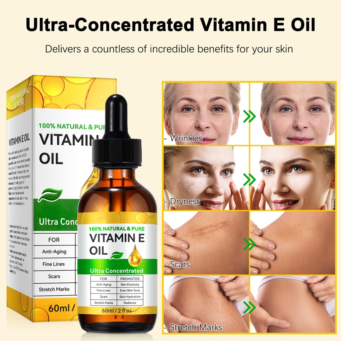 flasture Vitamin E Oil 75,000 IU – 100% Pure Natural Vitamin E for Skin, Face, Hair, Scars – Deep Moisturizing Body Oil for Dry Skin, Wrinkles – Cold-Pressed, Non-GMO,Skincare – 2 Fl Oz