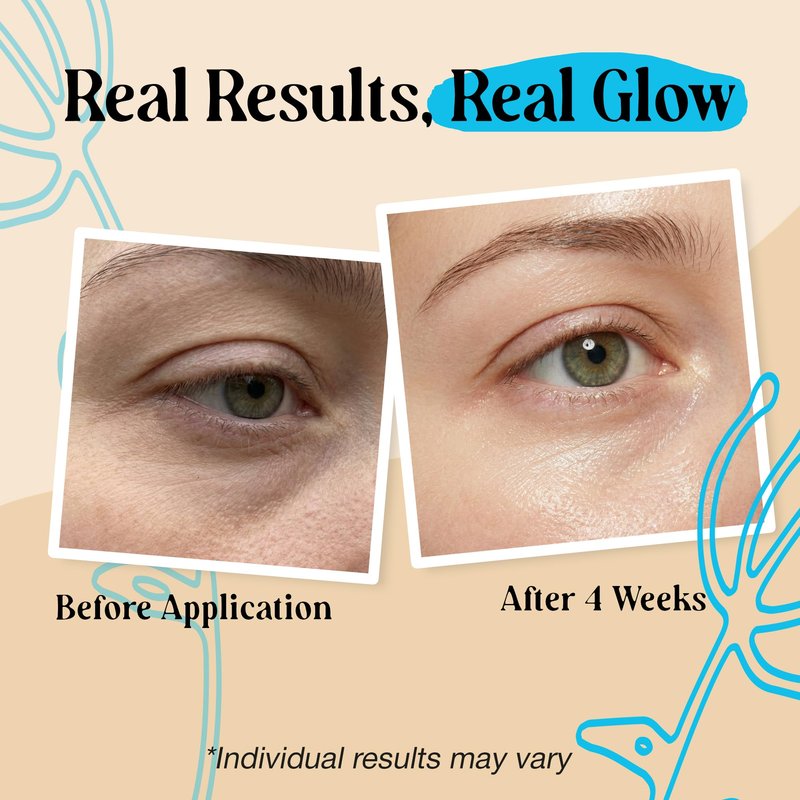 2 Pk 20g Under Eye Balm Stick Hydrating | 0.7 Oz Moisturizing Under Eye Brightener Stick w/Retinol, Aloe Vera, Vit E | Plumps, Hydrates & Reduces Dark Circles & Puffiness | Multipurpose Undereye Balm