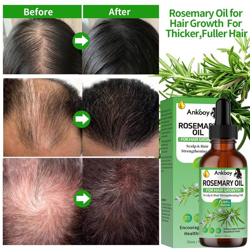 Rosemary Oil for Hair Growth - Strengthening Treatment for Dry, Damaged Hair | 3 Pack