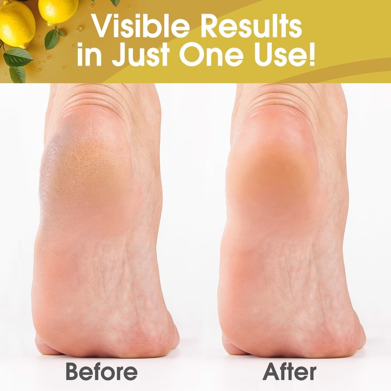 DeEnti Callus Remover for Feet, Extra Strength Foot Callus Remover Gel, 16oz Salon Grade Home Pedicure Supplies for Dry Skin, Cracked Heel, Professional Strength Foot Care, Lemon