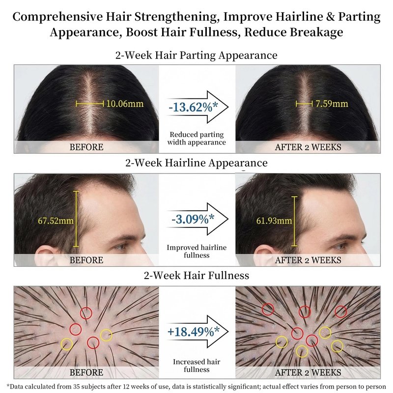 HONLINK Biotin Volumizing Shampoo for Fuller-Looking Hair – Scalp Care Formula with Argan Oil for Lightweight Strength, Hydration & Natural Shine, for Women & Men, 300ml