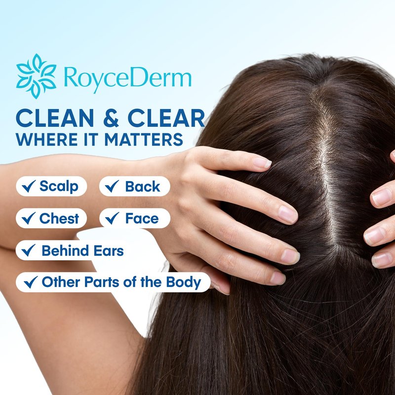 Roycederm Seborrheic & Psoriasis Calming Serum: Clinically Inspired Care for Itch, Dryness, Redness & Flaking - Seborrheic Dermatitis & Psoriasis Scalp Treatment Suitable for Scalp, Face & Body