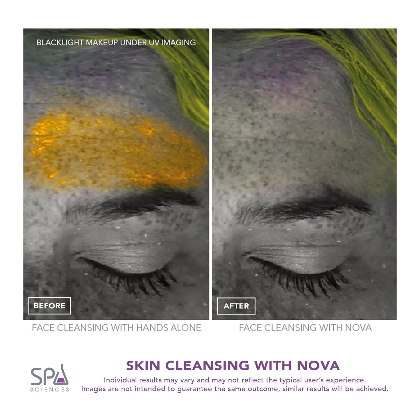 Spa Sciences - NOVA - Cleansing Brush with Bristles & Infusion System – Anti-Aging Facial Exfoliating, Waterproof, and USB Rechargeable