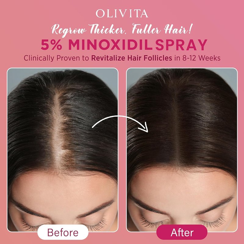 Regine Switzerland 5% Minoxidil Spray for Women | Extra Strength Hair Growth Treatment - Revitalize Follicles & Regrow Thicker Hair - 2 Pack