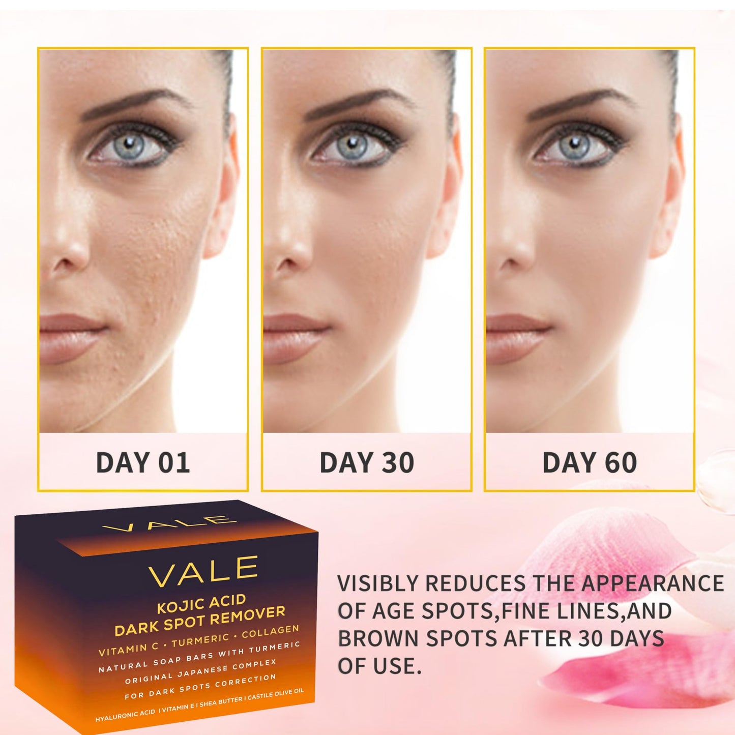 VALE Kojic Acid & Turmeric Soap Bar (2-Pack) – Natural Dark Spot Remover & Original Japanese Complex with Vitamin C, E, Collagen, Retinol, Olive Oil & Shea Butter(Citrus)