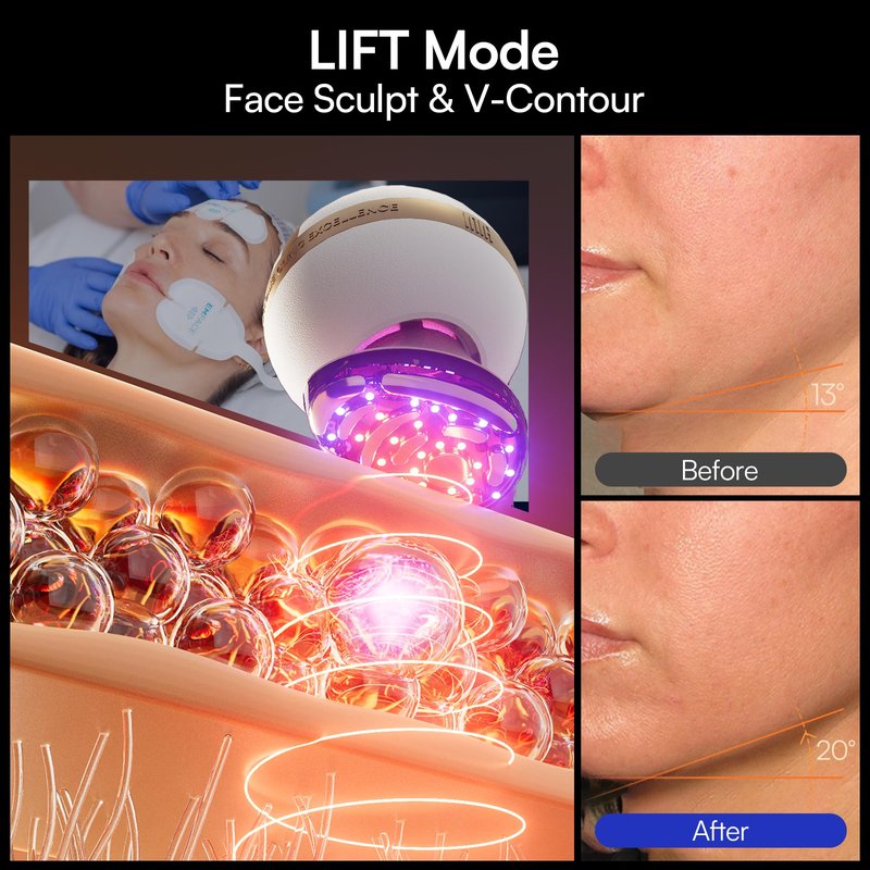 INIA SPHERA Upgraded 8-in-1 Microcurrent Facial Device for Face & Neck – Red Light, Thermal & Cooling Beauty Tool, 5 Custom Modes, At-Home Skin Stimulation & Glow Care Skincare Tool