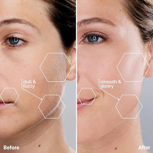 Facial Hair Removal for Women - Painless Facial Hair Remover - Electric Hair Removal Device for Face Lips Peach Fuzz with Light (Rose Gold)