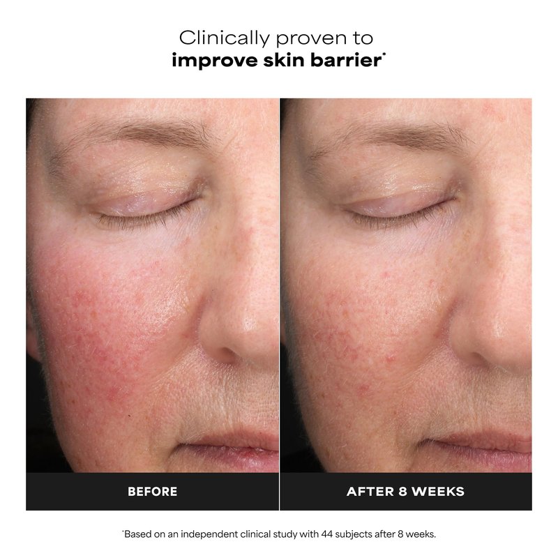 Paula’s Choice 6% Mandelic Acid + 2% Lactic Acid Exfoliant, Gentle Daily AHA Exfoliation for Discoloration, Bumpy Texture & Radiance, for Sensitive Skin, Fragrance-Free, 3 Fl. Oz.
