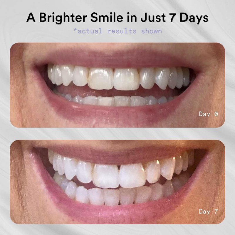 La Bouche Natural Teeth Whitening Strips, Professional Results, Maximum Whitening Power, Fresh Mint Flavor, 14 Treatments