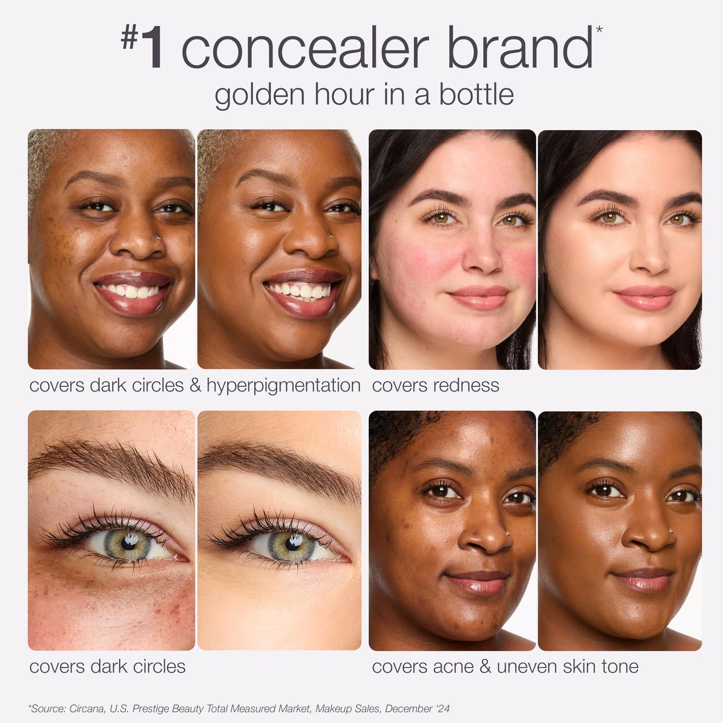 tarte shape tape radiant concealer – Medium-Coverage, Hydrating Finish Under Eye Concealer for Dark Circles, Redness & Discoloration, Vegan, Cruelty-Free, full size, 22N light neutral