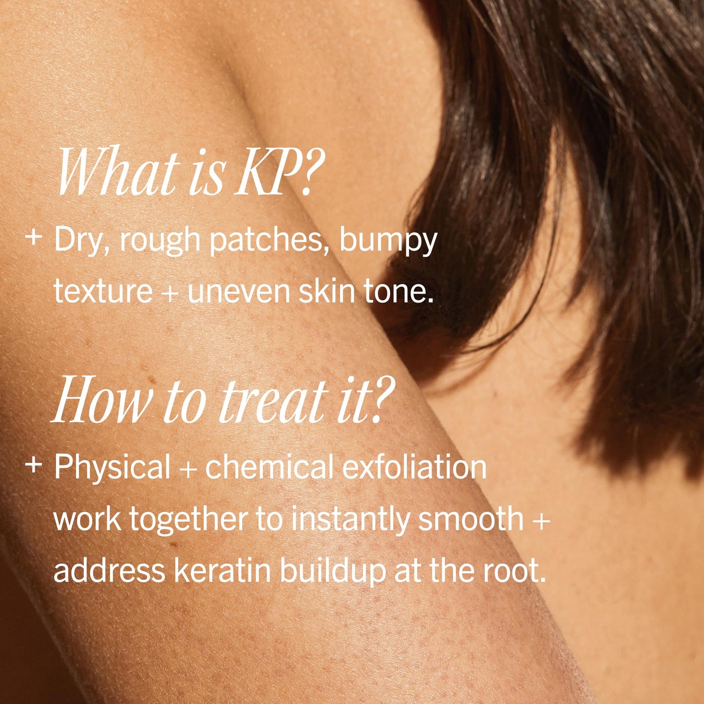 First Aid Beauty KP Bump Eraser Body Scrub with 10% AHA - Dermatologist-Tested Keratosis Pilaris Exfoliator - Support for Rough Bumps & Uneven Skin Texture - Sensitive Skin - 2 oz, Fresh Peach
