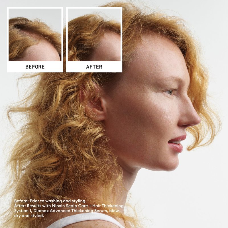 Nioxin Scalp + Hair Thickening System 1 Conditioner | For Natural or Untreated Hair with Light Thinning | With Niacinamide and Biotin | 33.8 Fl oz.