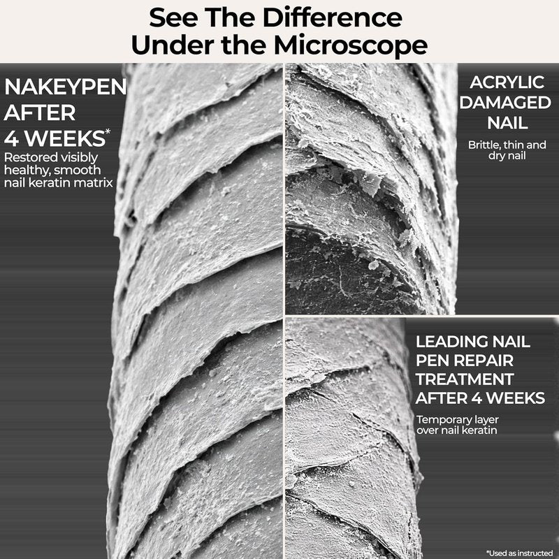 NakeyNails Nail Strengthening Serum - Fast Absorbing Treatment for Damaged & Brittle Nails | 45-Day Supply with Keratin, Peptides & Hyaluronic Acid