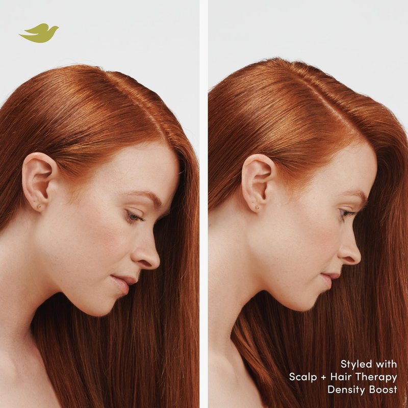 Dove Density Boost Strengthening Conditioner Scalp + Hair Therapy for protecting against premature breakage, with Vitamin B3, Zinc and 0% sulfates, 9.25 oz