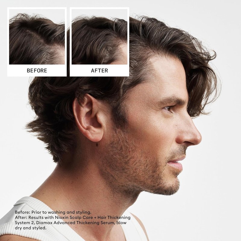 NIOXIN System 2 Scalp & Hair Thickening Conditioner - Boost Density with Niacinamide & Biotin | For Natural Hair