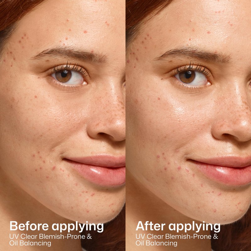 EltaMD UV Clear Blemish-Prone & Oil Balancing SPF 50, Non-Comedogenic Sunscreen with Zinc Oxide, Dermatologist Recommended