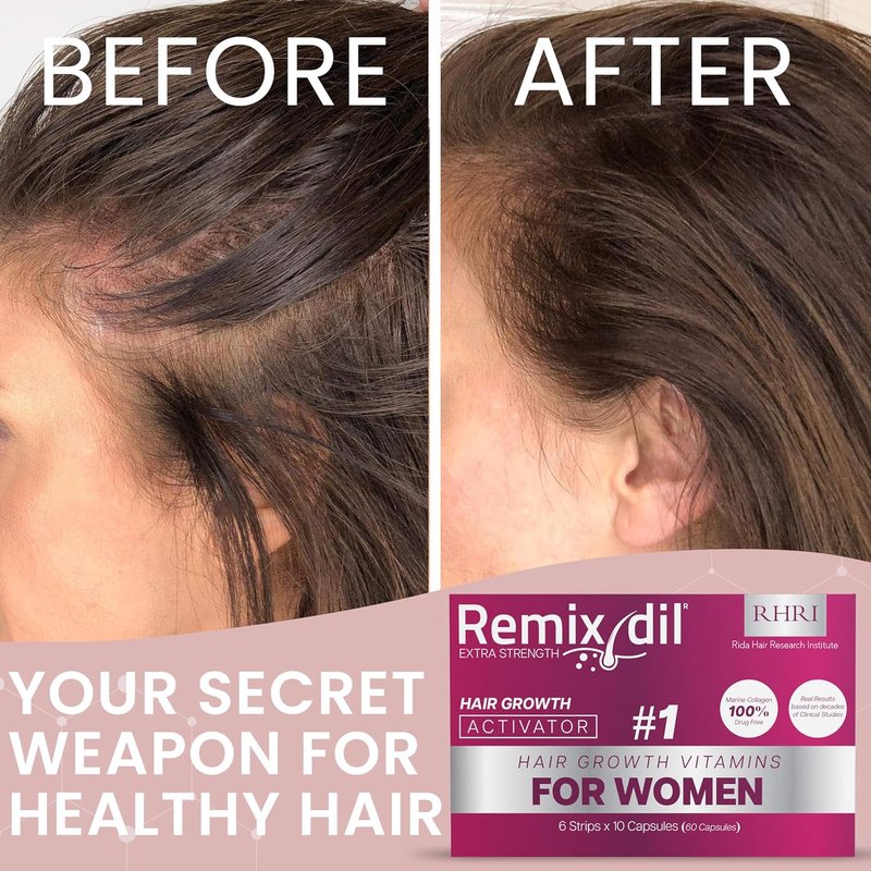 Skiennix Hair Growth Vitamins - Supports Thickness & Strength | Reduces Breakage & Thinning | 60 Capsules