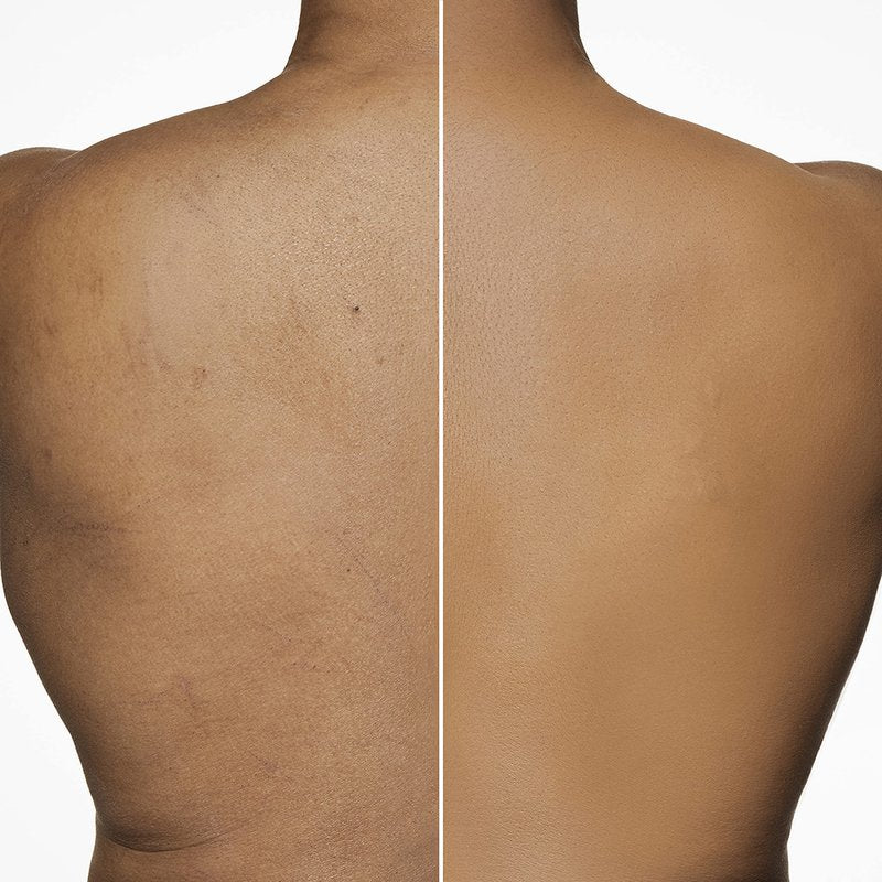 Dermablend Leg and Body Makeup Foundation with SPF 25, 65N Tan Golden, 3.4 Fl. Oz.