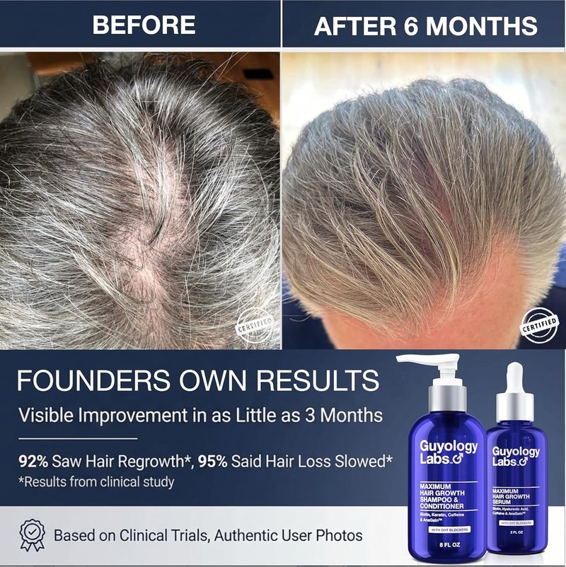 Hair Growth Shampoo & Conditioner - DHT Blocker for Hair Loss & Regrowth | 2% AnaGain™, Biotin & Caffeine | Minoxidil Compatible