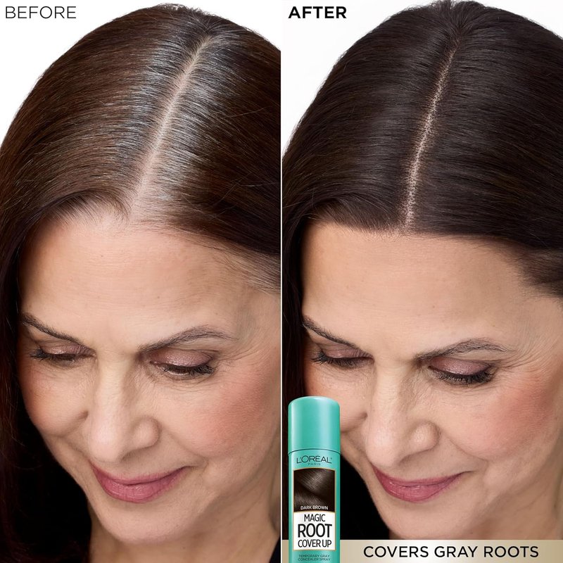 L'Oreal Paris Magic Root Cover Up - Dark Brown Gray Hair Spray | 100% Coverage, Ammonia-Free, 2 oz (2 Count)