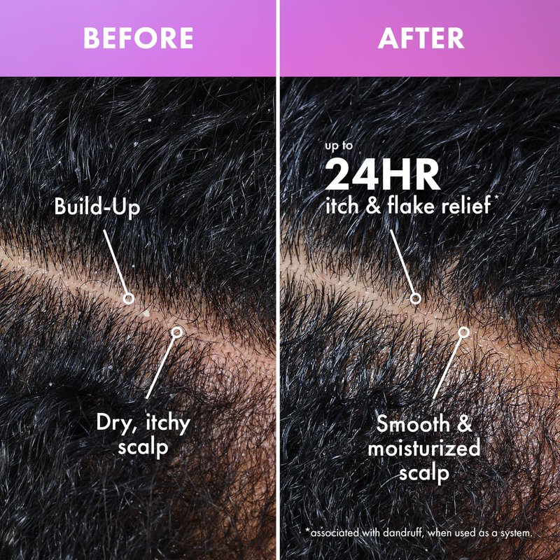 Mielle Organics Lavender & Lychee Scalp Moisturizing Shampoo with 1% Pyrithione Zinc – Anti-Dandruff Shampoo for Flake & Itch Relief, Sulfate-Free, 12 fl oz