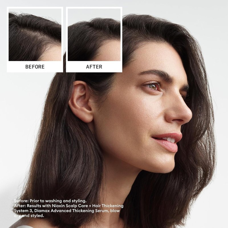Nioxin System 3 Conditioner - Scalp & Hair Thickening for Colored, Dry, & Damaged Hair | Nourish with Niacinamide & Biotin
