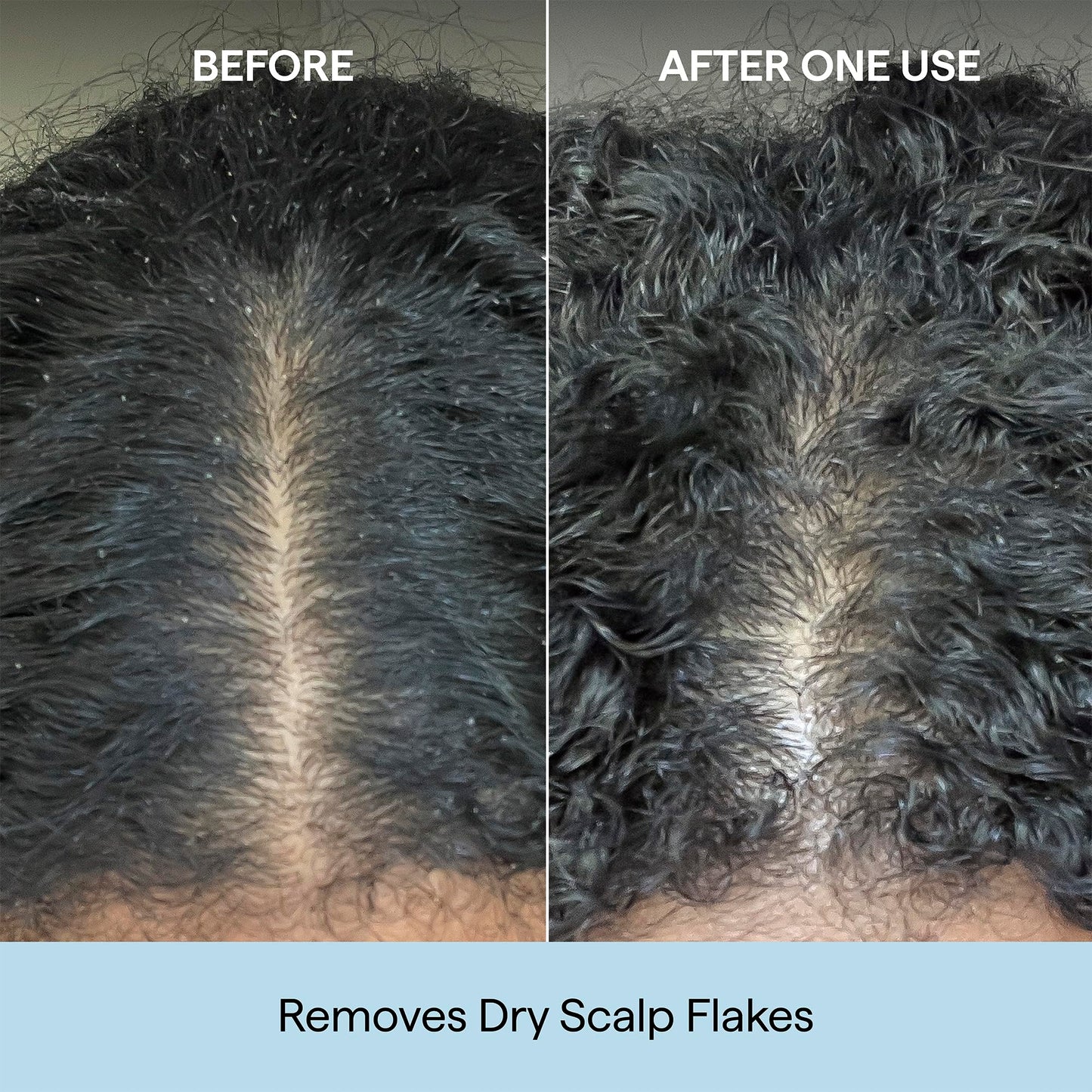 Briogeo Scalp Revival Charcoal + Coconut Oil Micro-Exfoliating Shampoo | Sulfate-Free Scalp Scrub for Dry, Itchy, or Oily Scalp | Detoxifying & Hydrating | Vegan & Cruelty Free | 8 oz