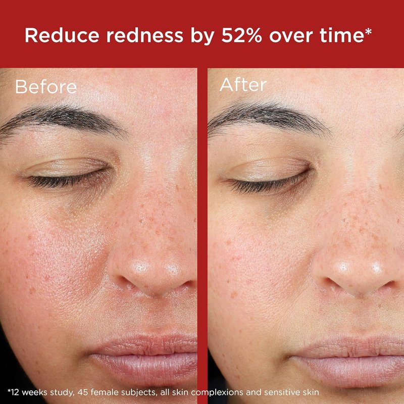 EltaMD UV Skin Recovery Face Sunscreen with Zinc Oxide, All Mineral, Safe for Sensitive Skin SPF 50