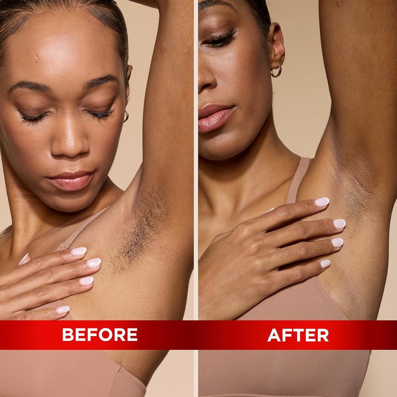 Magic Razorless Shaving Cream - Extra Strength Depilatory Hair Removal for Body Hair | 6 oz