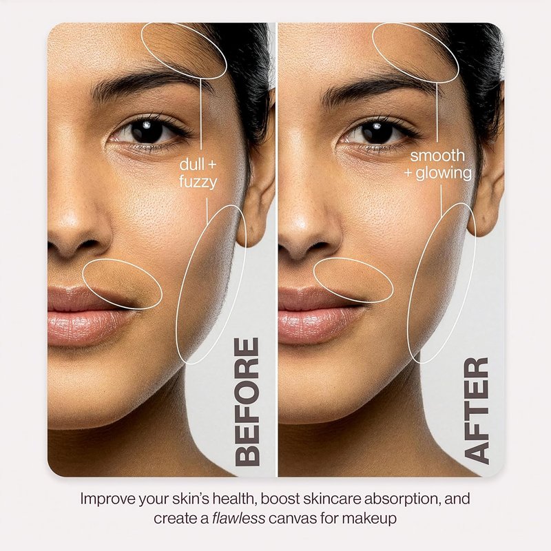 DERMAFLASH LUXE+ Sonic Dermaplaning Tool - Effective Peach Fuzz Removal & Anti-Aging Exfoliation